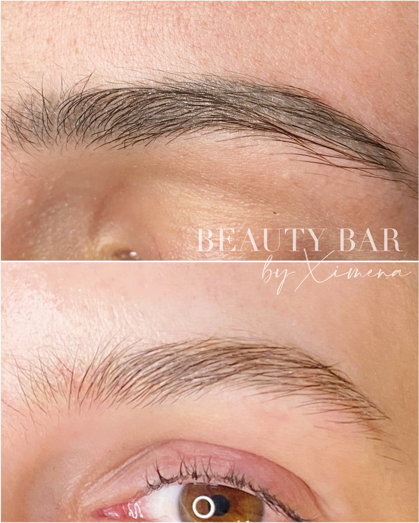 Philaser Brows