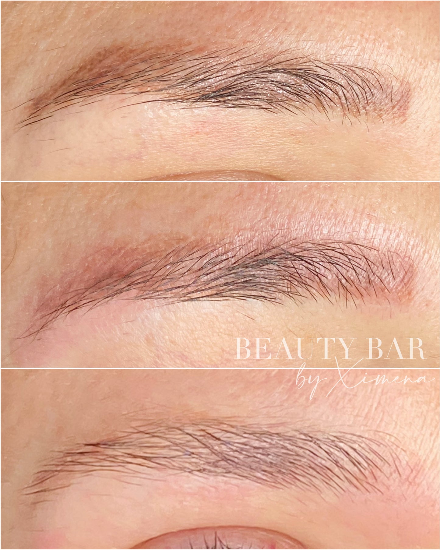 Philaser Brows